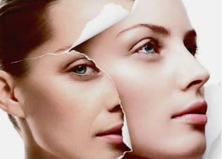 αντενδείξεις για λέιζερ αναζωογονήσετε